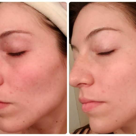 2 X FACIAL SHEET MASK BENTON Snail Bee High Content Mask Packs - Picture 5 of 7